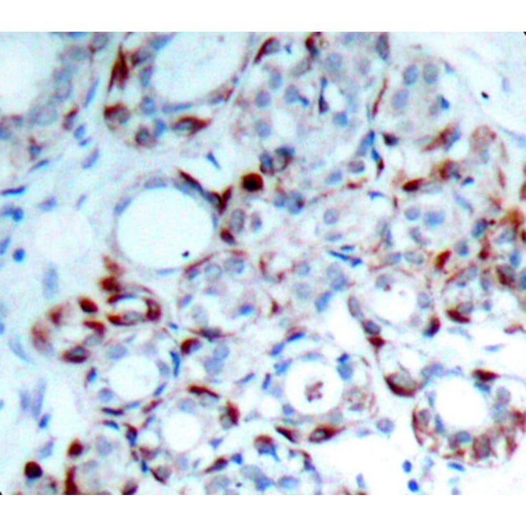 Immunohistochemistry - Anti-BCL2L11 (phospho S69) Antibody (AP0313) - Antibodies.com