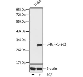 Western Blot - Anti-Bcl-XL (phospho Ser62) Antibody (A16574) - Antibodies.com
