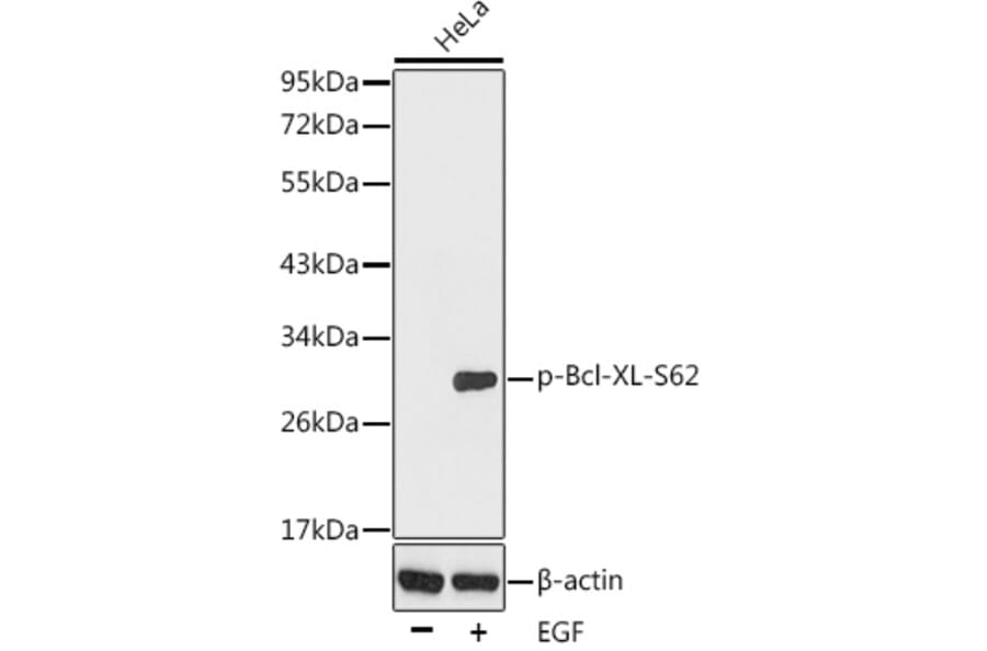 Western Blot - Anti-Bcl-XL (phospho Ser62) Antibody (A16574) - Antibodies.com