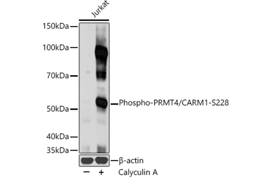 Western Blot - Anti-CARM1 (phospho Ser228) Antibody (A16575) - Antibodies.com