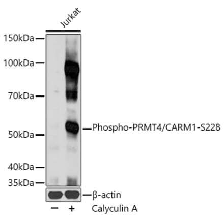 Western Blot - Anti-CARM1 (phospho Ser228) Antibody (A16575) - Antibodies.com