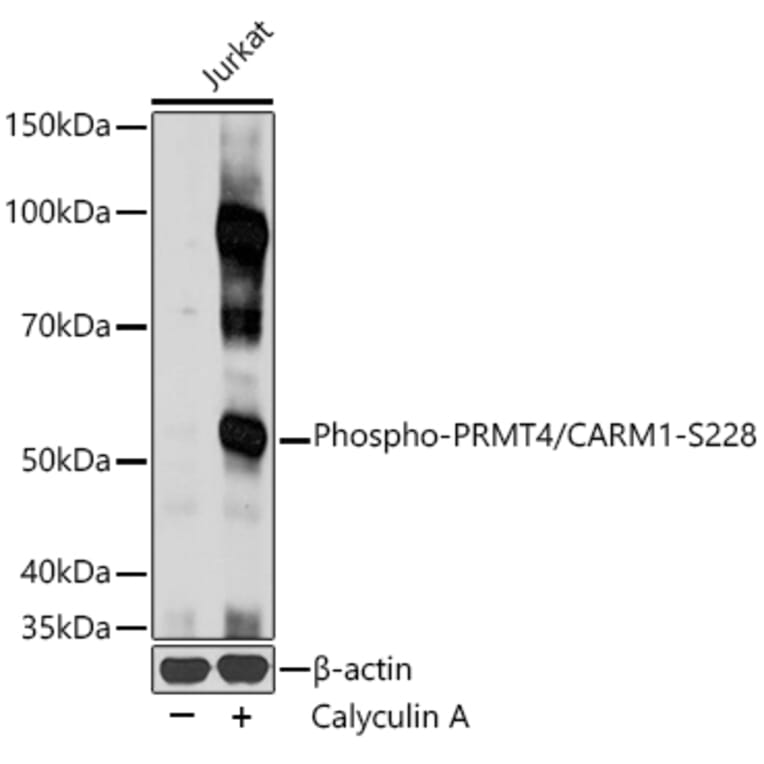 Western Blot - Anti-CARM1 (phospho Ser228) Antibody (A16575) - Antibodies.com