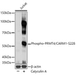 Western Blot - Anti-CARM1 (phospho Ser228) Antibody (A16575) - Antibodies.com