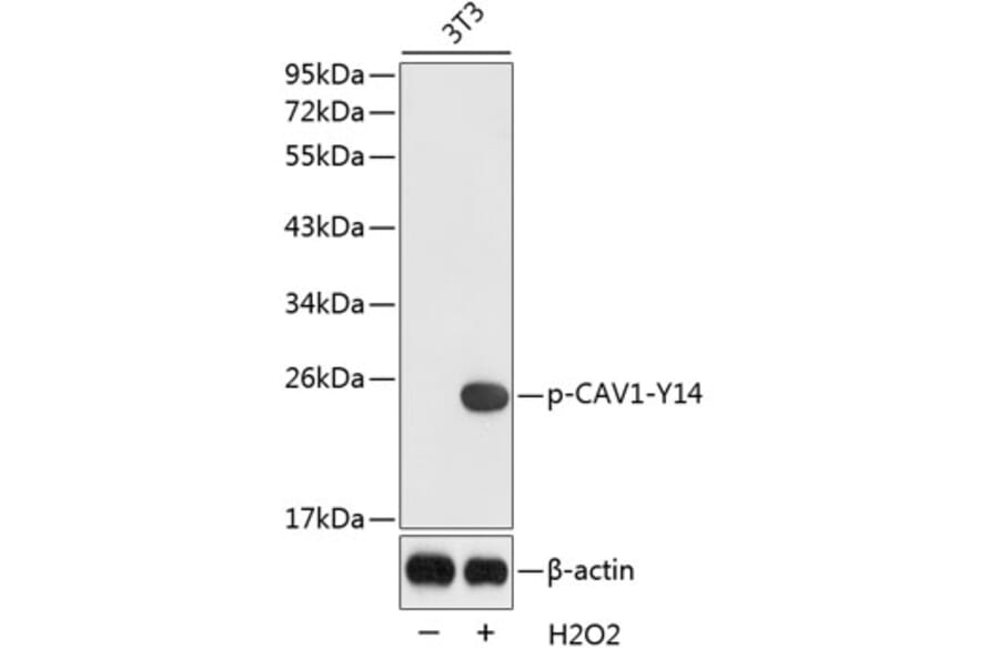Western Blot - Anti-CAV1 (phospho Y14) Antibody (AP0320) - Antibodies.com