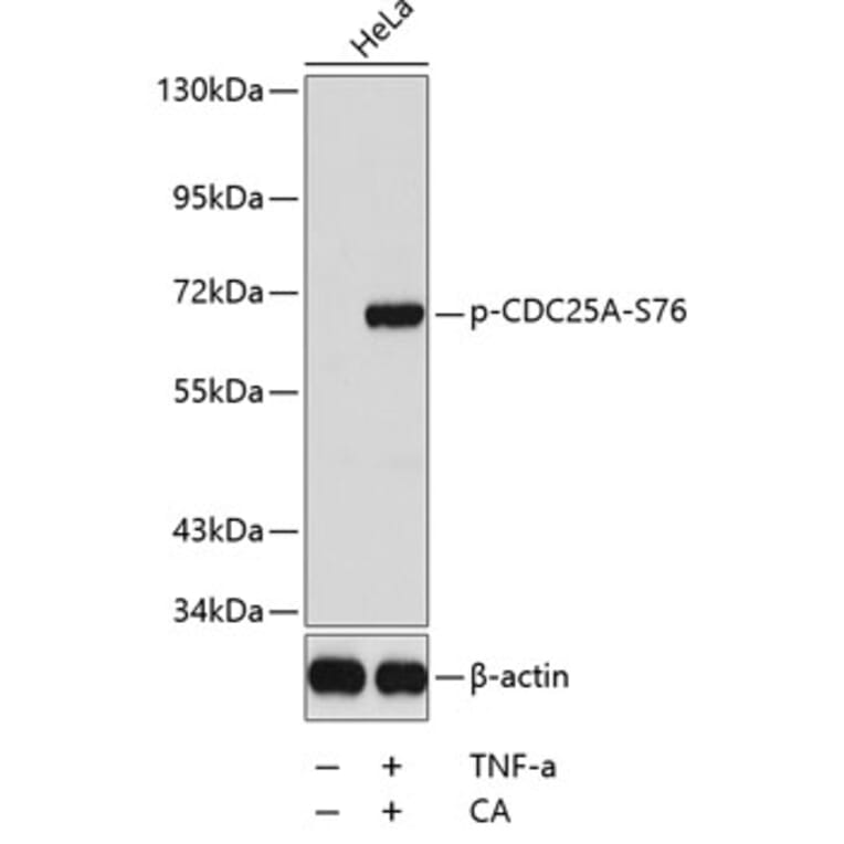 Western Blot - Anti-CDC25A (phospho S76) Antibody (AP0321) - Antibodies.com