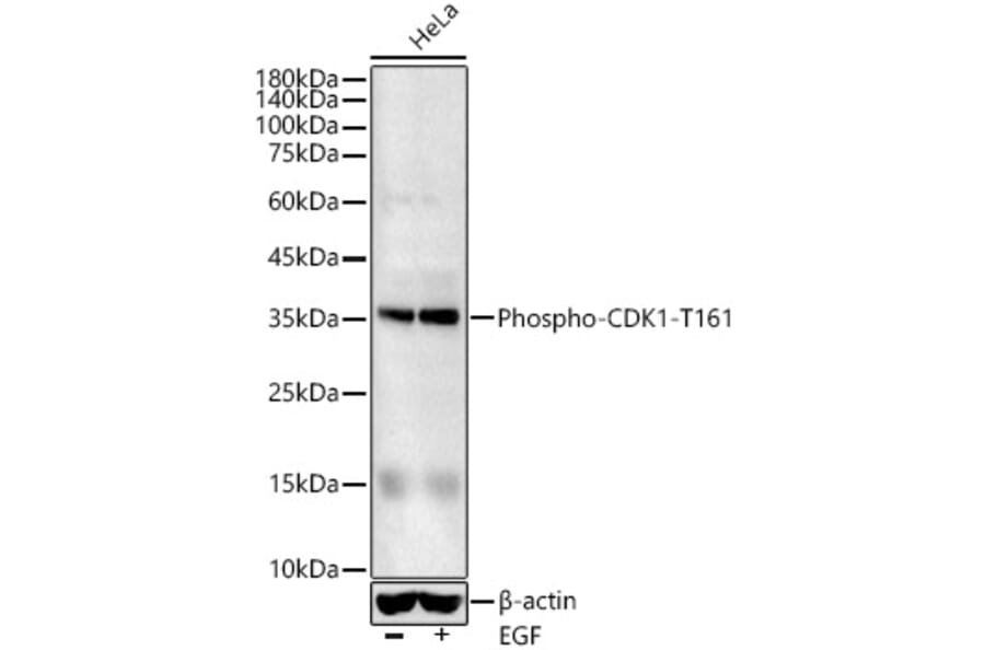 Western Blot - Anti-CDK1 (phospho Thr161) Antibody (A16578) - Antibodies.com