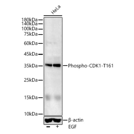 Western Blot - Anti-CDK1 (phospho Thr161) Antibody (A16578) - Antibodies.com