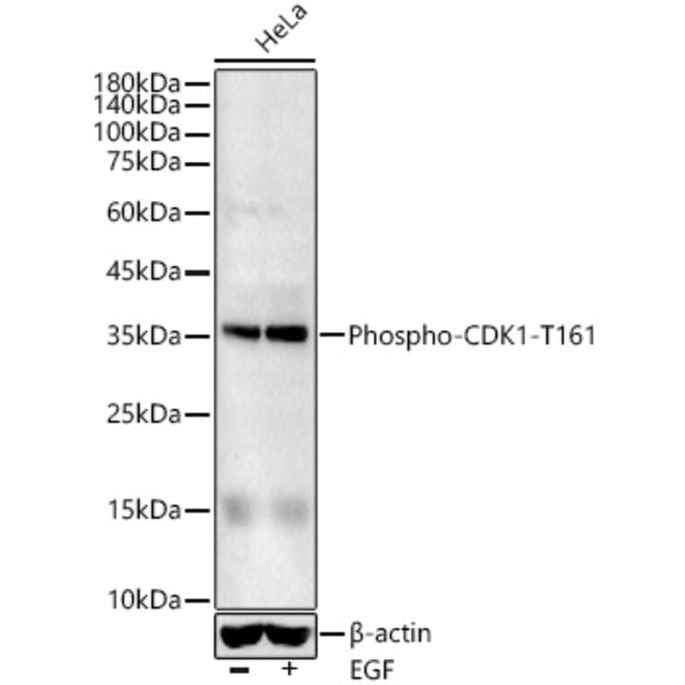 Western Blot - Anti-CDK1 (phospho Thr161) Antibody (A16578) - Antibodies.com