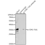 Western Blot - Anti-CDK1 (phospho Thr161) Antibody (A16578) - Antibodies.com