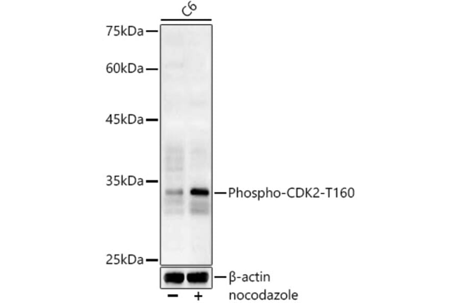 Western Blot - Anti-CDK2 (phospho Thr160) Antibody (A16579) - Antibodies.com
