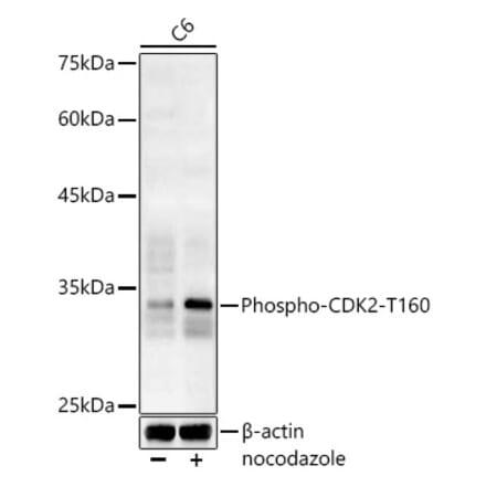 Western Blot - Anti-CDK2 (phospho Thr160) Antibody (A16579) - Antibodies.com