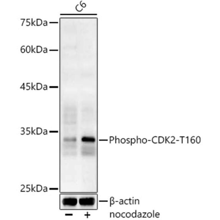 Western Blot - Anti-CDK2 (phospho Thr160) Antibody (A16579) - Antibodies.com