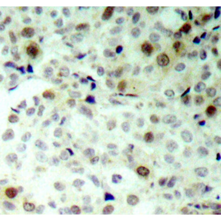 Immunohistochemistry - Anti-CDK2 (phospho Thr160) Antibody (A16579) - Antibodies.com