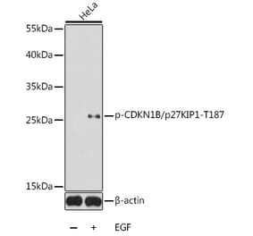 Western Blot - Anti-p27 KIP 1 (phospho Thr187) Antibody (A16580) - Antibodies.com