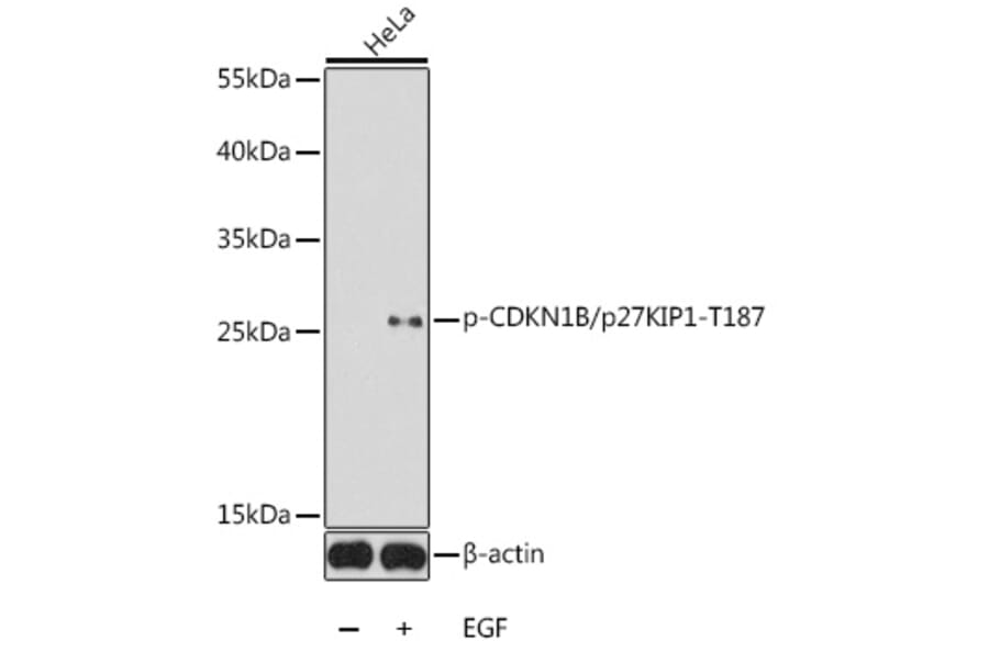 Western Blot - Anti-p27 KIP 1 (phospho Thr187) Antibody (A16580) - Antibodies.com