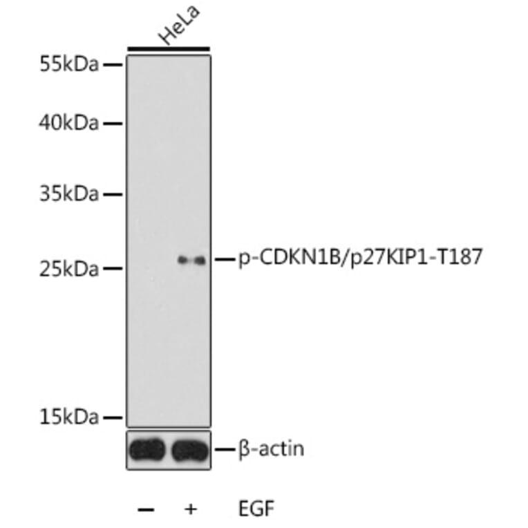 Western Blot - Anti-p27 KIP 1 (phospho Thr187) Antibody (A16580) - Antibodies.com