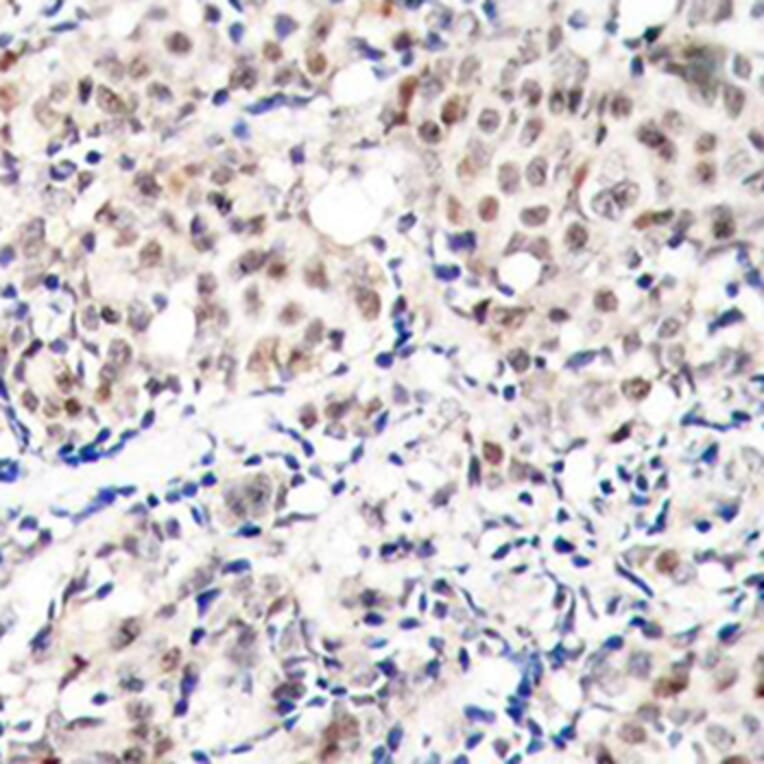 Immunohistochemistry - Anti-p27 KIP 1 (phospho Thr187) Antibody (A16580) - Antibodies.com