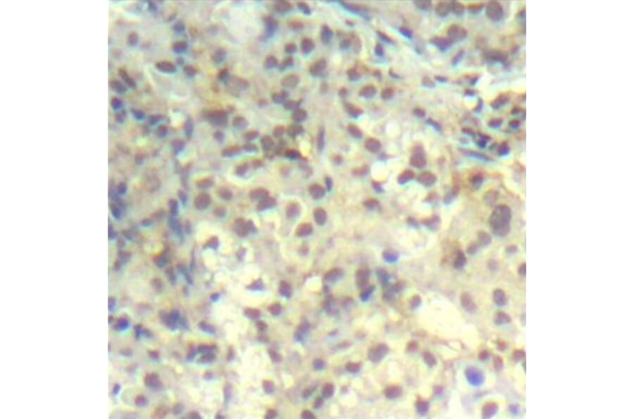 Immunohistochemistry - Anti-CFL1 (phospho Y139) Antibody (AP0330) - Antibodies.com