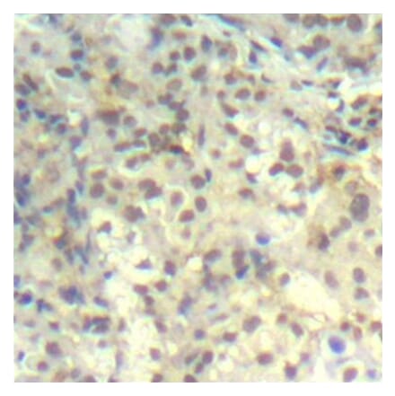 Immunohistochemistry - Anti-CFL1 (phospho Y139) Antibody (AP0330) - Antibodies.com