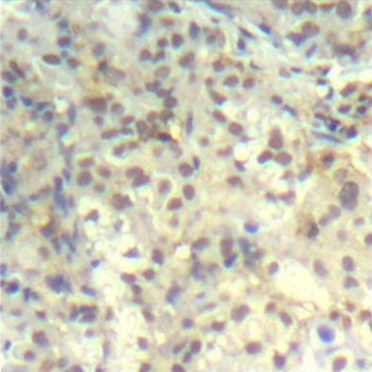Immunohistochemistry - Anti-CFL1 (phospho Y139) Antibody (AP0330) - Antibodies.com