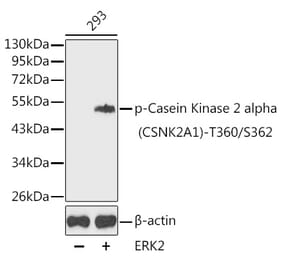 Western Blot - Anti-CSNK2A1 (phospho Thr360 + Ser362 ) Antibody (A16584) - Antibodies.com