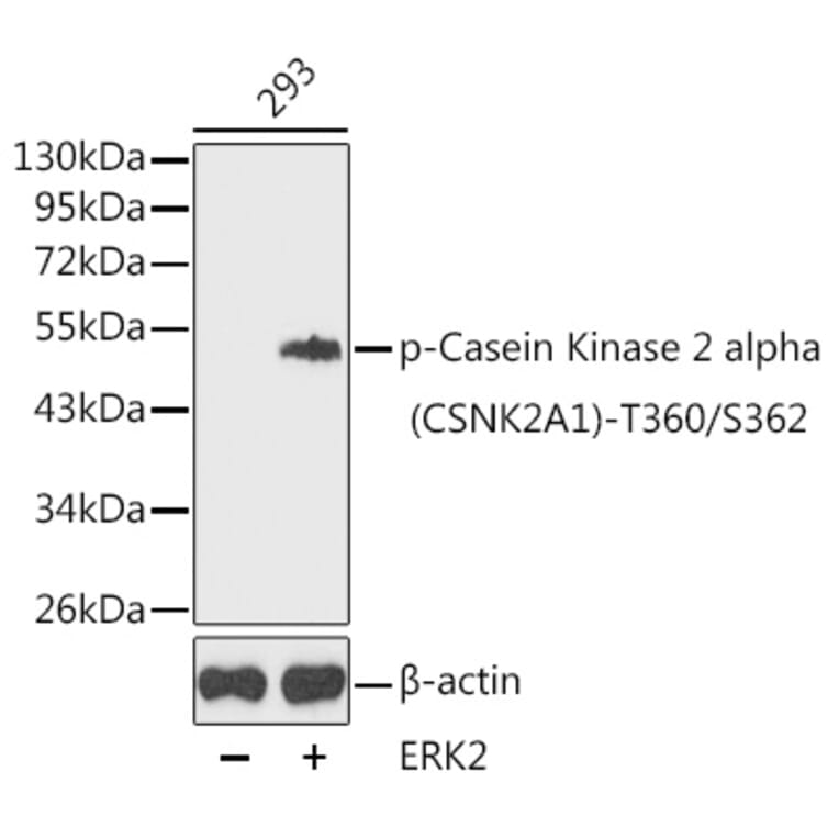 Western Blot - Anti-CSNK2A1 (phospho Thr360 + Ser362 ) Antibody (A16584) - Antibodies.com