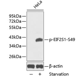 Western Blot - Anti-EIF2S1 (phospho Ser49) Antibody (A16585) - Antibodies.com
