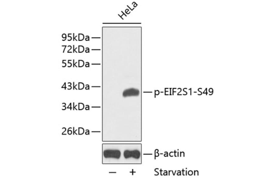 Western Blot - Anti-EIF2S1 (phospho Ser49) Antibody (A16585) - Antibodies.com