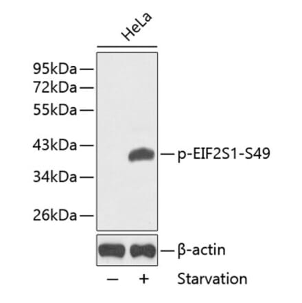 Western Blot - Anti-EIF2S1 (phospho Ser49) Antibody (A16585) - Antibodies.com