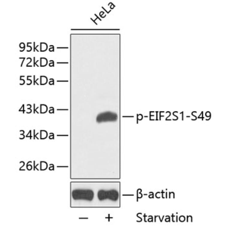 Western Blot - Anti-EIF2S1 (phospho Ser49) Antibody (A16585) - Antibodies.com