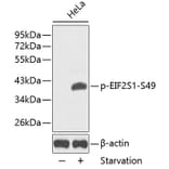 Western Blot - Anti-EIF2S1 (phospho Ser49) Antibody (A16585) - Antibodies.com