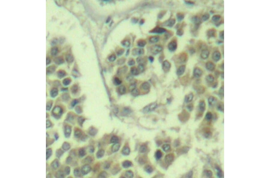 Immunohistochemistry - Anti-EIF2S1 (phospho Ser49) Antibody (A16585) - Antibodies.com