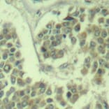 Immunohistochemistry - Anti-EIF2S1 (phospho Ser49) Antibody (A16585) - Antibodies.com