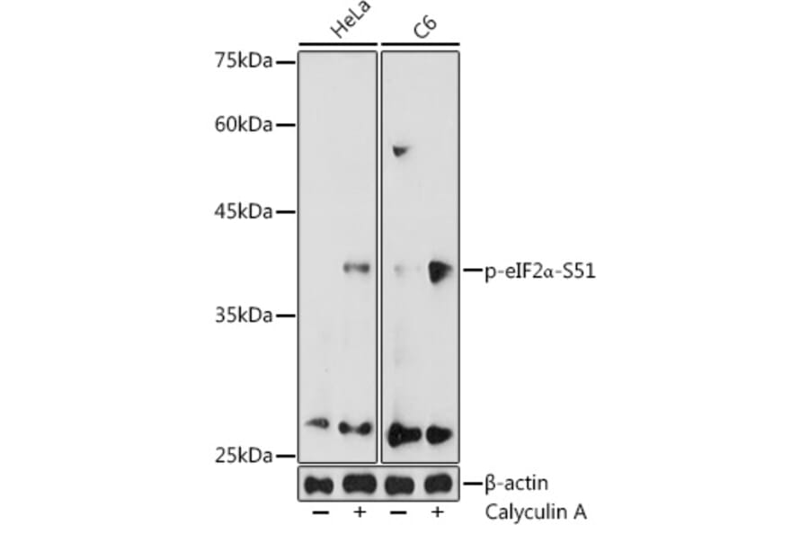 Western Blot - Anti-EIF2S1 (phospho Ser51) Antibody (A16586) - Antibodies.com