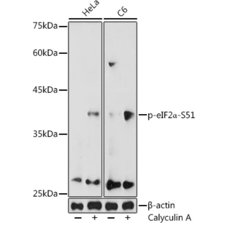 Western Blot - Anti-EIF2S1 (phospho Ser51) Antibody (A16586) - Antibodies.com