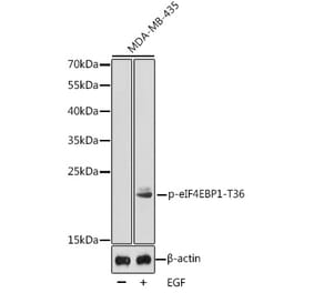 Western Blot - Anti-eIF4EBP1 (phospho Thr36) Antibody (A16587) - Antibodies.com