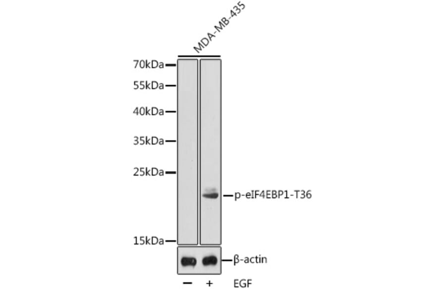 Western Blot - Anti-eIF4EBP1 (phospho Thr36) Antibody (A16587) - Antibodies.com