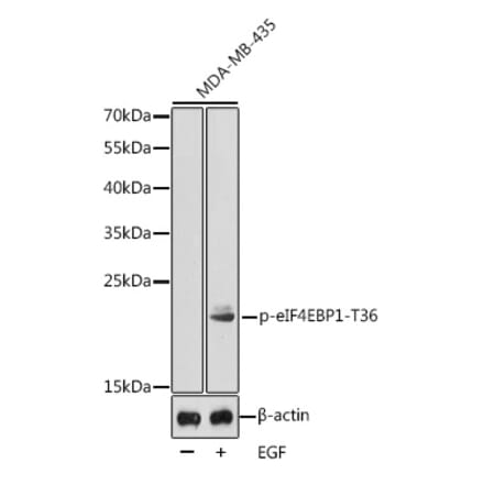 Western Blot - Anti-eIF4EBP1 (phospho Thr36) Antibody (A16587) - Antibodies.com