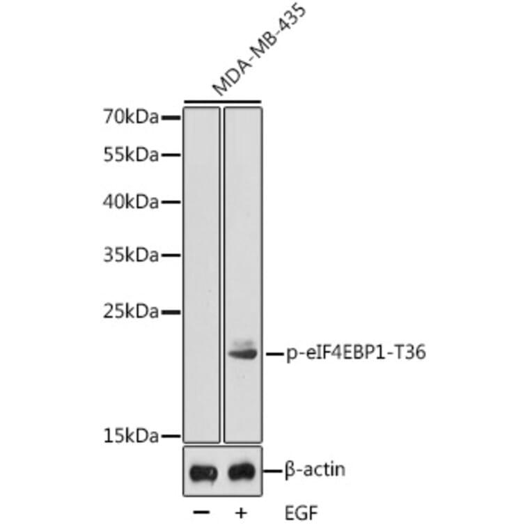 Western Blot - Anti-eIF4EBP1 (phospho Thr36) Antibody (A16587) - Antibodies.com