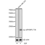 Western Blot - Anti-eIF4EBP1 (phospho Thr36) Antibody (A16587) - Antibodies.com