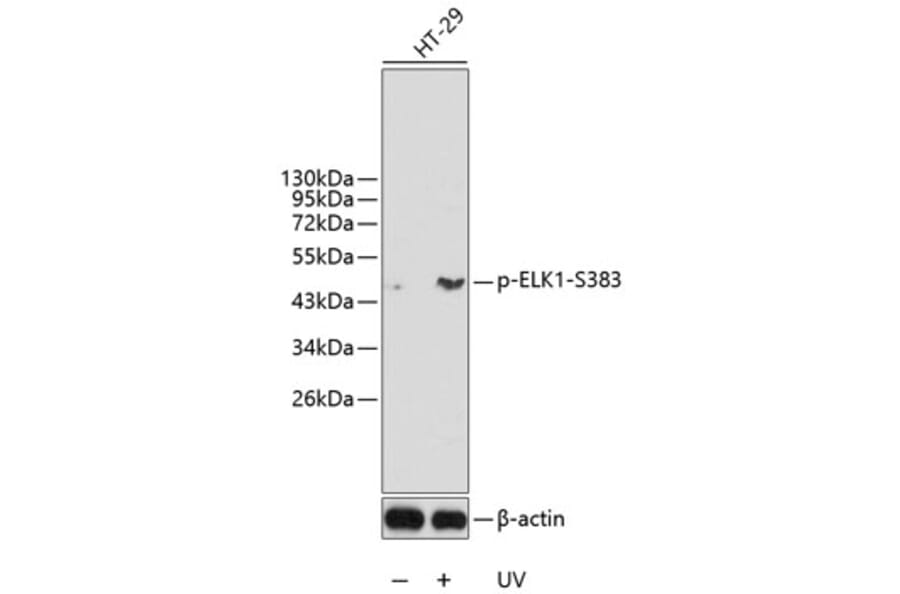 Western Blot - Anti-ELK1 (phospho S383) Antibody (AP0345) - Antibodies.com