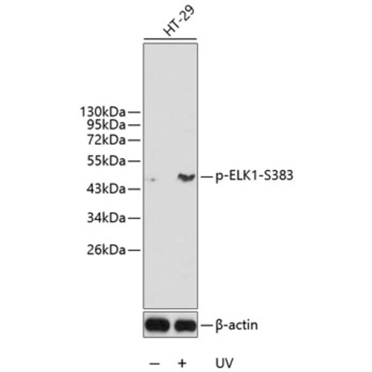 Western Blot - Anti-ELK1 (phospho S383) Antibody (AP0345) - Antibodies.com