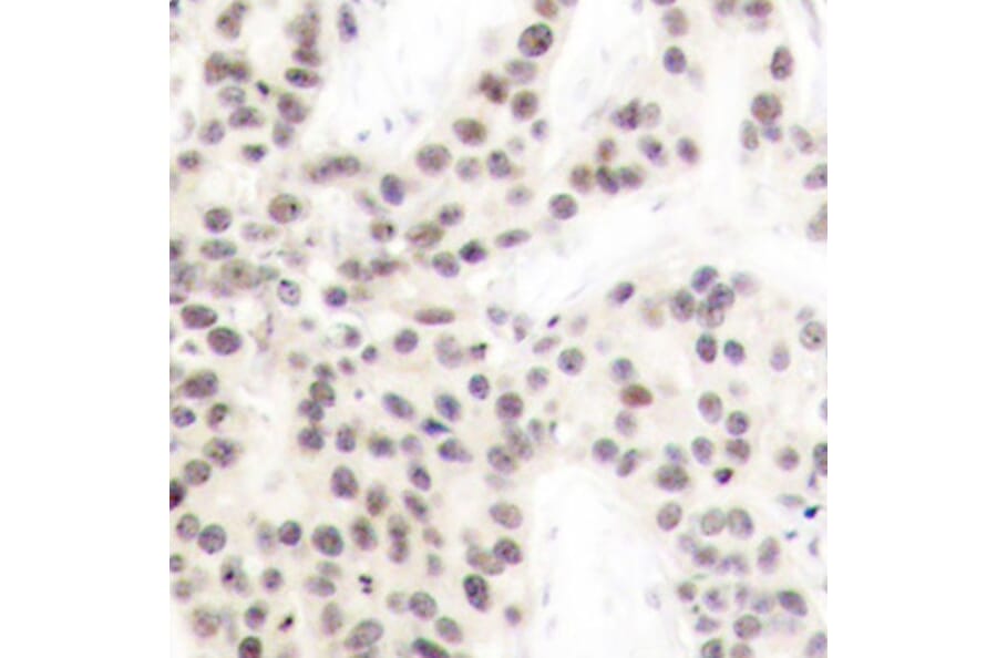 Immunohistochemistry - Anti-ELK1 (phospho T417) Antibody (AP0346) - Antibodies.com