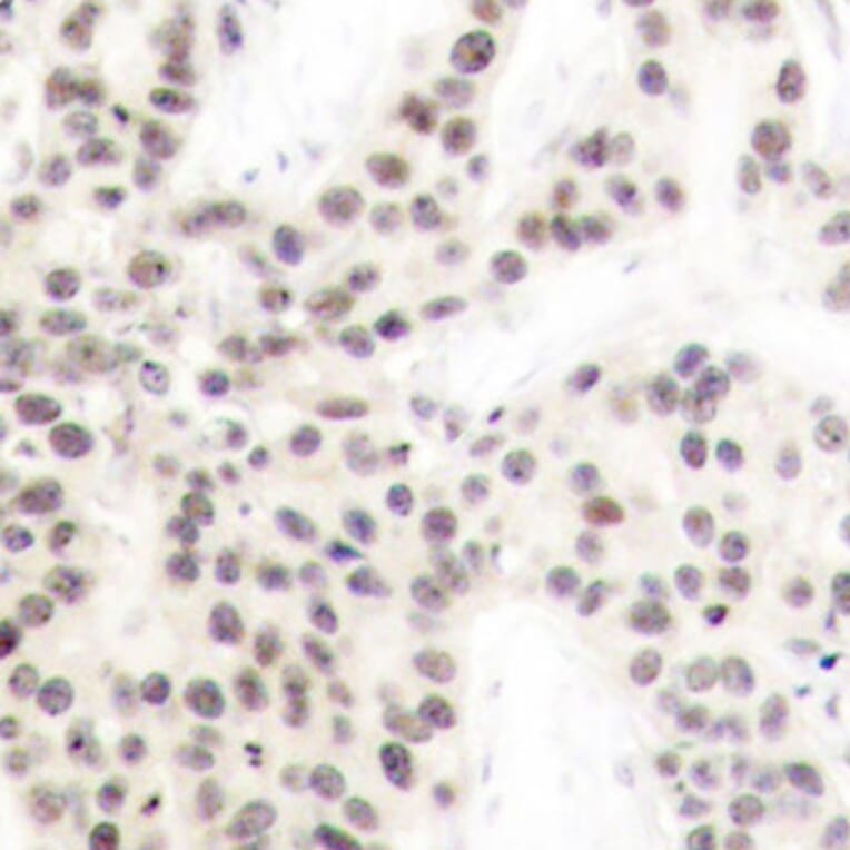 Immunohistochemistry - Anti-ELK1 (phospho T417) Antibody (AP0346) - Antibodies.com