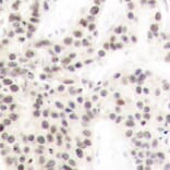 Immunohistochemistry - Anti-ELK1 (phospho T417) Antibody (AP0346) - Antibodies.com