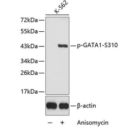 Western Blot - Anti-GATA1 (phospho Ser310) Antibody (A16592) - Antibodies.com
