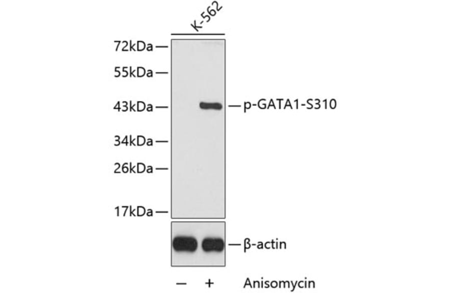 Western Blot - Anti-GATA1 (phospho Ser310) Antibody (A16592) - Antibodies.com