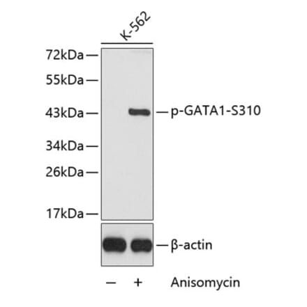 Western Blot - Anti-GATA1 (phospho Ser310) Antibody (A16592) - Antibodies.com
