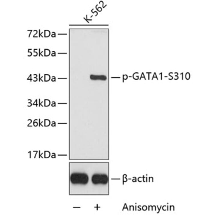 Western Blot - Anti-GATA1 (phospho Ser310) Antibody (A16592) - Antibodies.com