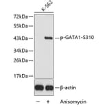 Western Blot - Anti-GATA1 (phospho Ser310) Antibody (A16592) - Antibodies.com